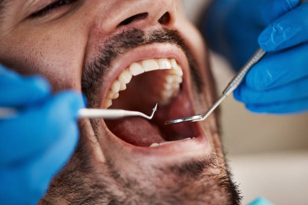 Best Emergency Pediatric Dental Care in Pine Manor, FL